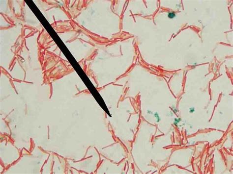 endospore stain results|endospore stain negative.